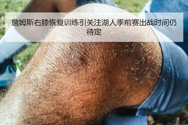 詹姆斯右膝恢复训练引关注湖人季前赛出战时间仍待定